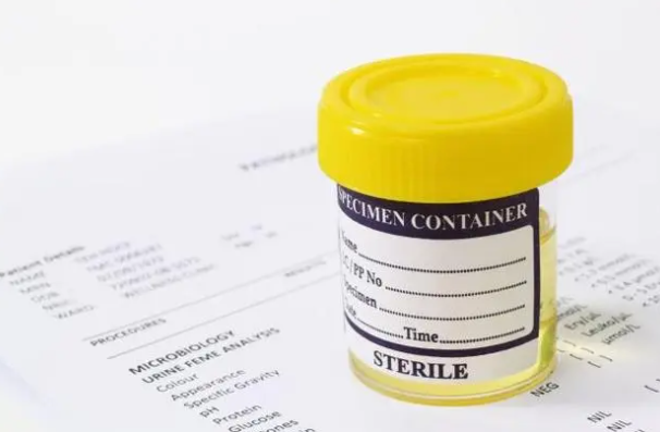 全球首例!女子能用膀胱自动酿酒,无限续杯…