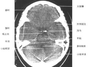 热心的朝阳群众51cg10fun热门大瓜