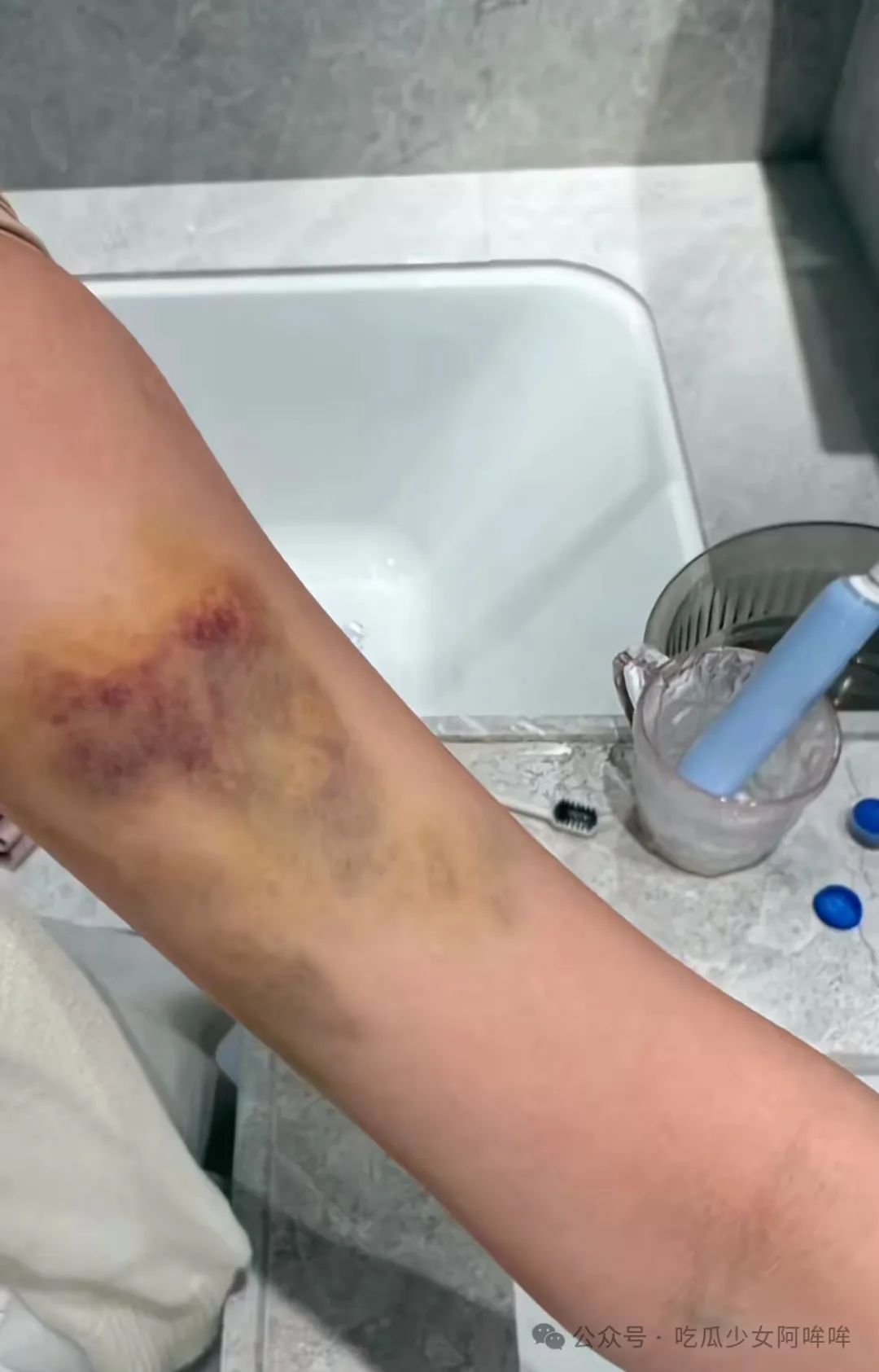 三观炸裂!最绿茶的百万女网红,跟男友确定关系第二天就去找榜一男闺蜜做饭。自己受伤却造谣男友家暴,网友:男友实惨!